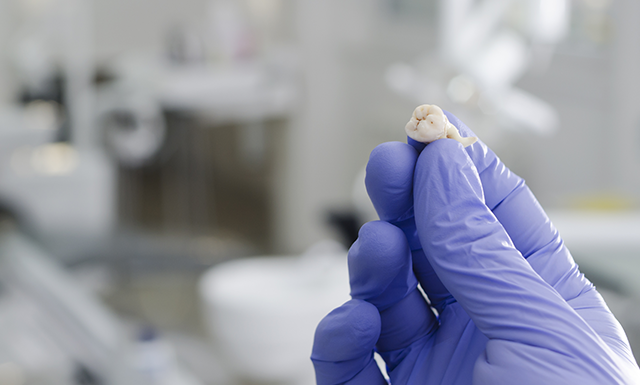 Wisdom Tooth Infection Chelsea, London