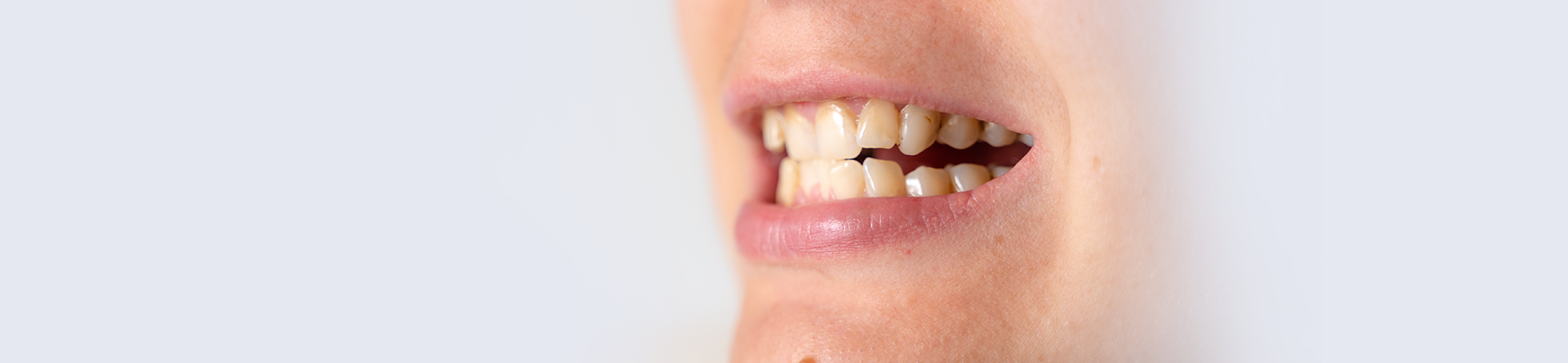 Loose Tooth Banner – Emergency Dental Clinic Chelsea